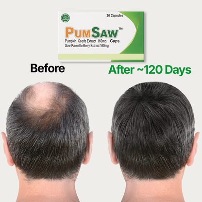 Pumsaw Pumpkin & Saw Palmetto – Natural DHT Blocker - Hair Loss Prevention & Prostate Support